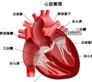 青年心肌梗死