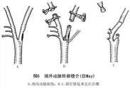 四肢血管損傷 四肢血管損傷