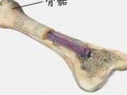 先天性半側(cè)肥大