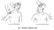 神經(jīng)根型頸椎病